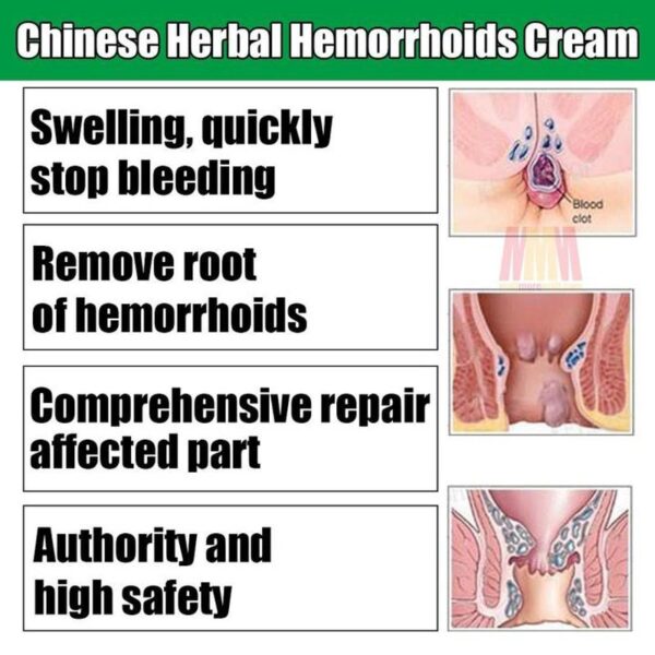 Acne Medicine Hemorrhoids Cream